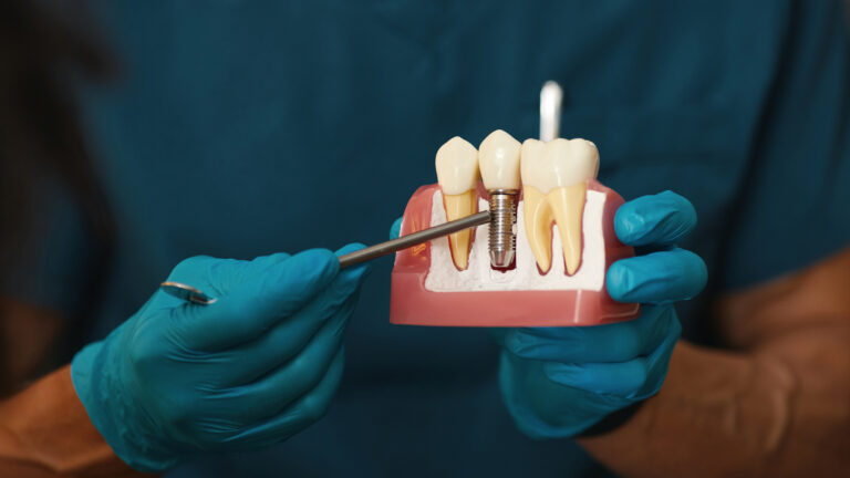 dental-implants-vs-dentures
